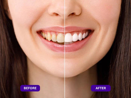 💜 Purple Whitening Mouthwash | Brighter Smile in Just 30 Seconds